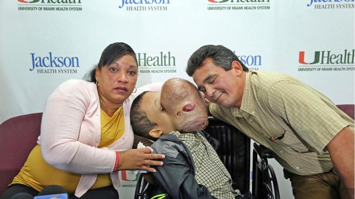 Emanuel Zayas, de 14 años, pocos días antes de su operación en el Hospital de Niños Holtz de Jackson Memorial in Miami, junto a sus padres Noel Zayas and Melvis Vizcaino. El pequeño murió por complicaciones que no pudieron superarse.