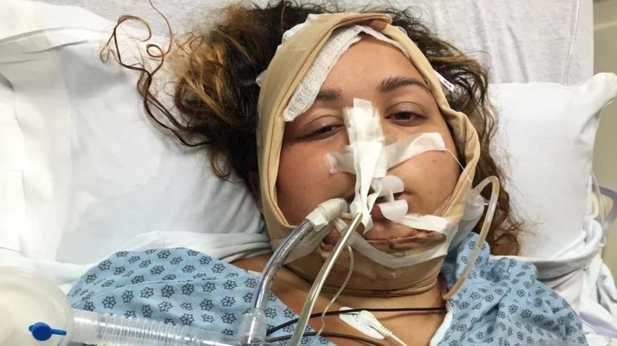 Catherine González, de 19 años y residente de Hialeah, sufrió varios paros respiratorios, tras someterse a una liposucción en la clínica Encore Plastic Surgery, en Hialeah, el pasado 7 de mayo.