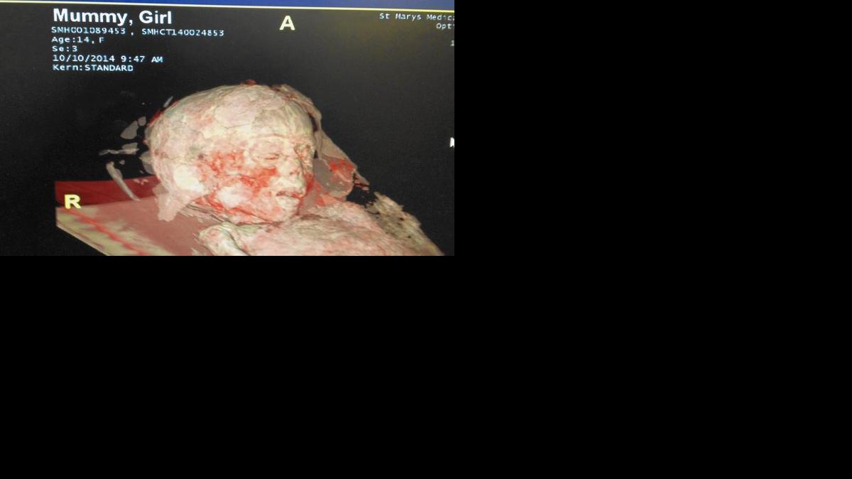
Los medicos no tenían una historia médica que les ayudara a desvelar la causa de la muerte de su paciente más vieja: una momia femenina de 2,100 años.
