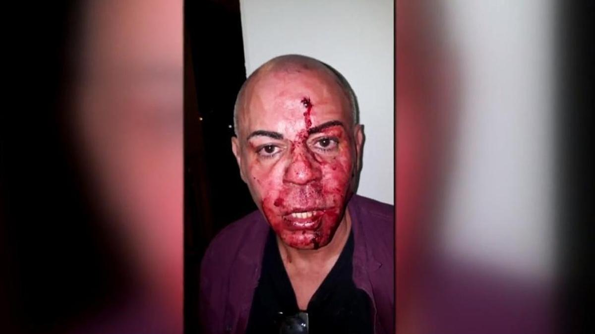 Captura de pantalla de un video de WPLG Local 10 que muestra a José González ensangrentado tras haber sido víctima del ataque de otra pasajera en un auto de Lyft.