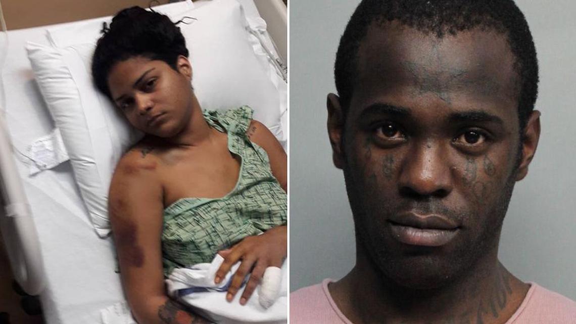 Cynthia Cortés en el hospital y la foto de arresto de Yosvanis Sierra, más conocido como ‘Chocolate’.