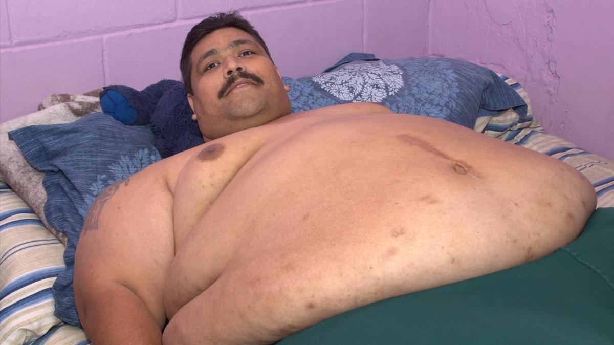 Fotografía cedida este lunes 26 de octubre de 2015, de Andrés Moreno, de 37 años, el hombre más obeso del mundo que alcanzó los 435 kilos y que será operado el próximo miércoles en un hospital mexicano.