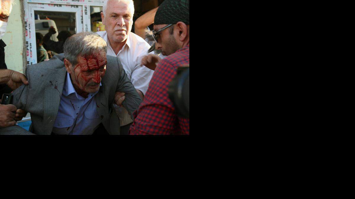 
Un sirio es ayudado el lunes por varias personas tras recibir una herida en el rostro causada por manifestantes turcos en la frontera con Siria.


