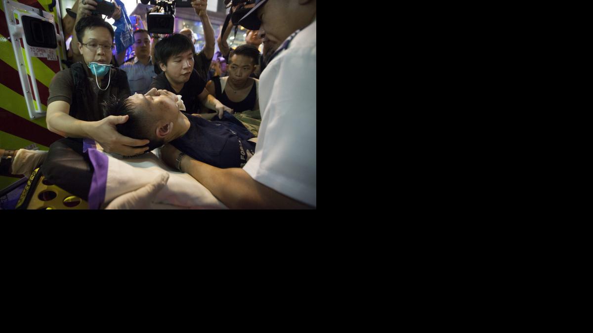 <cutline_leadin>Un joven</cutline_leadin> a favor del movimiento pro democrático que se vive en Hong Kong recibe atención médica tras resultar herido en los disturbios este viernes.