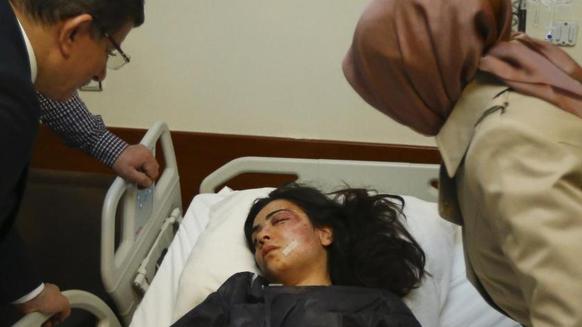 El gobierno turco acusó a los rebeldes del Partido de los Trabajadores del Kurdistán (PKK) de haber perpetrado el atentado con coche bomba que mató a por lo menos 35 civiles.