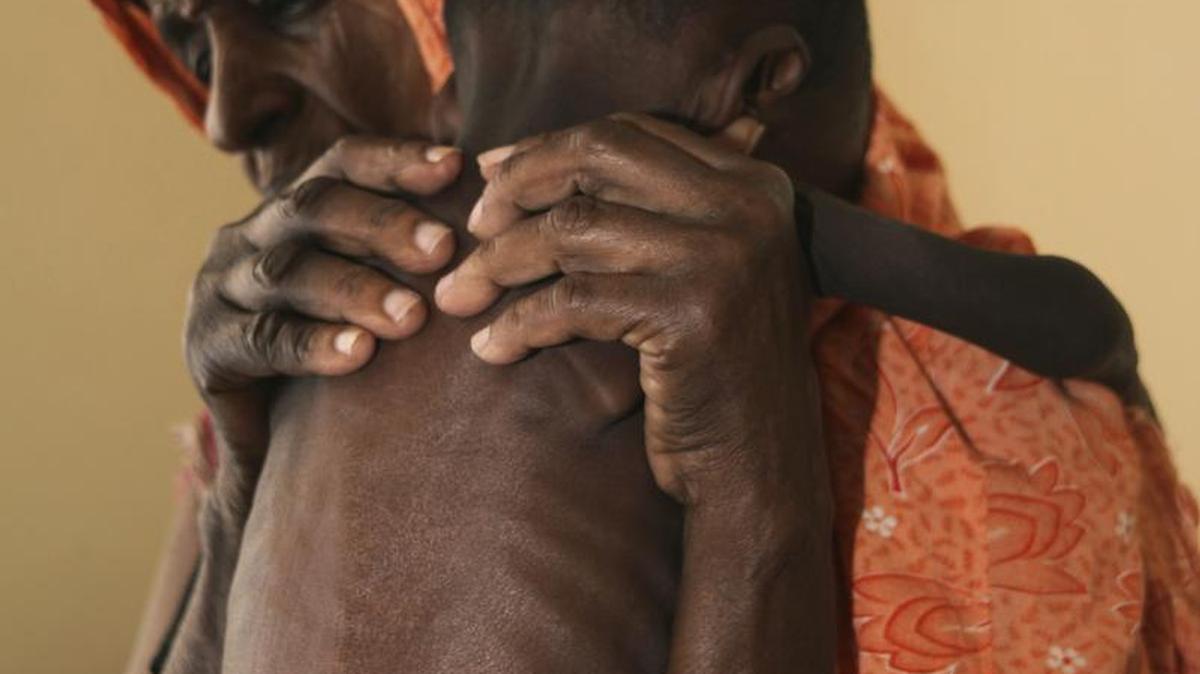 
La desnutrición y las condiciones de vida en la ciudad de Wajir en Kenya se hacen palpables en esta imagen de julio del 2011.
