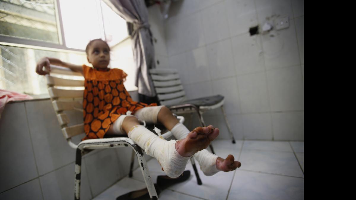 
Una niña, herida por un bombardeo de la coalición liderada por Arabia Saudita, recibe ayuda médica en Sanaa, Yemen.

