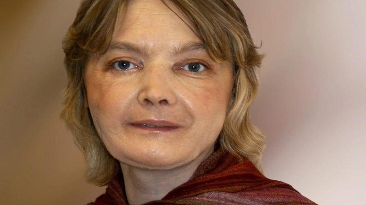 Isabelle Dinoire, la francesa que recibió el primer trasplante de rostro en el mundo falleció, 11 años después de la operación. Esta foto fue tomada en Amiens, Francia, por los componentes del equipo médico que llevó a cabo el primer trasplante de cara.