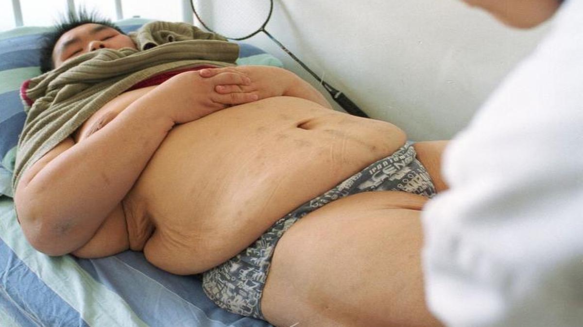 
Las tasas de sobrepeso y obesidad están creciendo a un ritmo preocupante en China, afirma el representante en el país de la Organización Mundial de la Salud (OMS), Bernhard Schwartländer.
