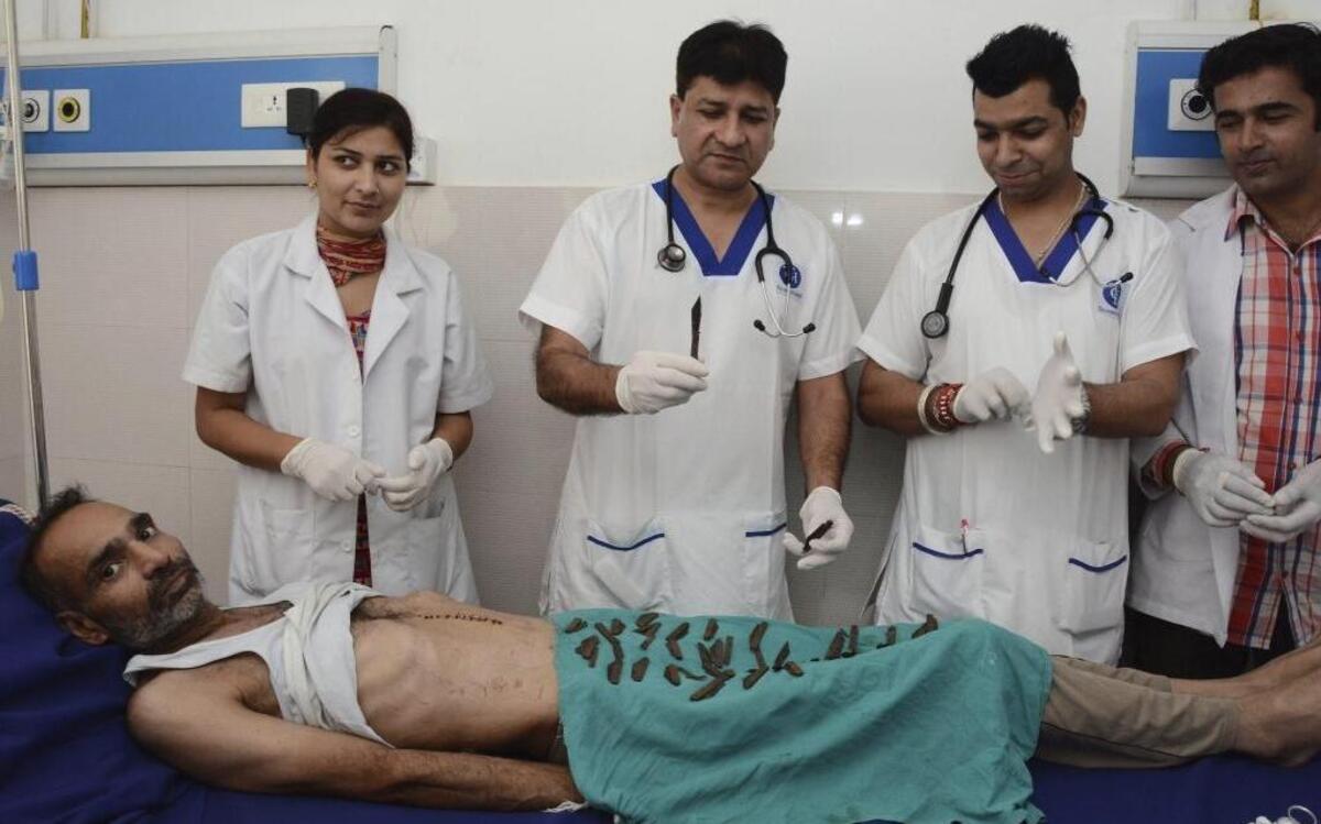 El Dr. Jatinder Malhorta (2i) y miembros de su equipo muestran los 40 navajas recuperadas del estómago de su paciente Surjeet Singh, tras ser operado en el hospital Corporate en Amritsar (India).