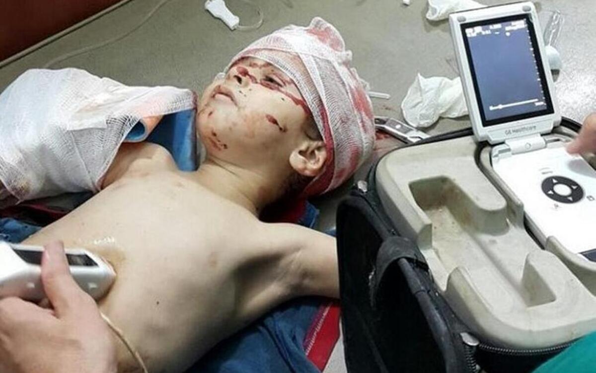 Ahmad Tadifi, de dos años, murió el 19 de agosto luego de varias operaciones.