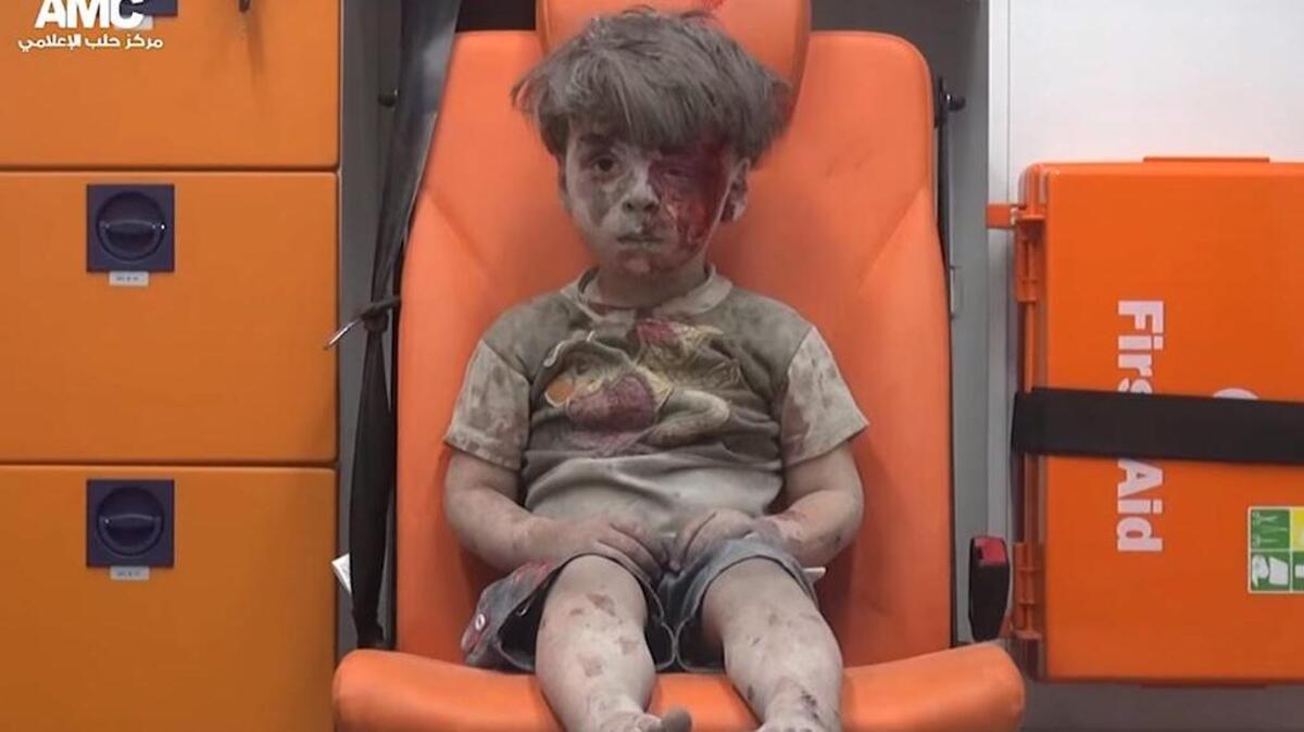 Un niño de cinco años ha puesto de nuevo rostro al drama que sufren los civiles a causa del devastador conflicto en Siria.