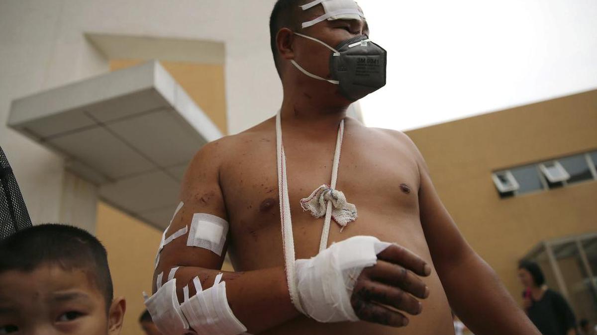 
 Un hombre herido camina por un refugio temporal tras la explosión de un almacén en Tianjin (China) hoy 14 de agosto de 2015. 
