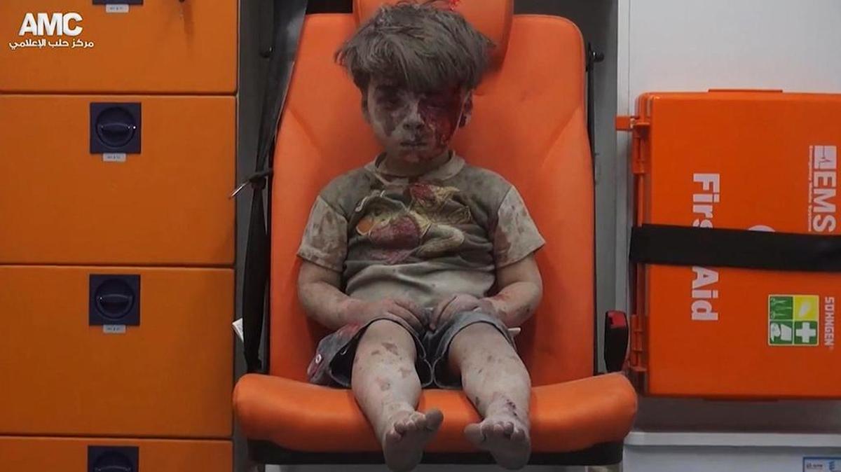 La imagen de Omran Daqneesh, el niño de 5 años rescatado el 17 de agosto de 2016 de una barrio que fue bombardeado, se convirtió en un símbolo de la guerra civil siria.