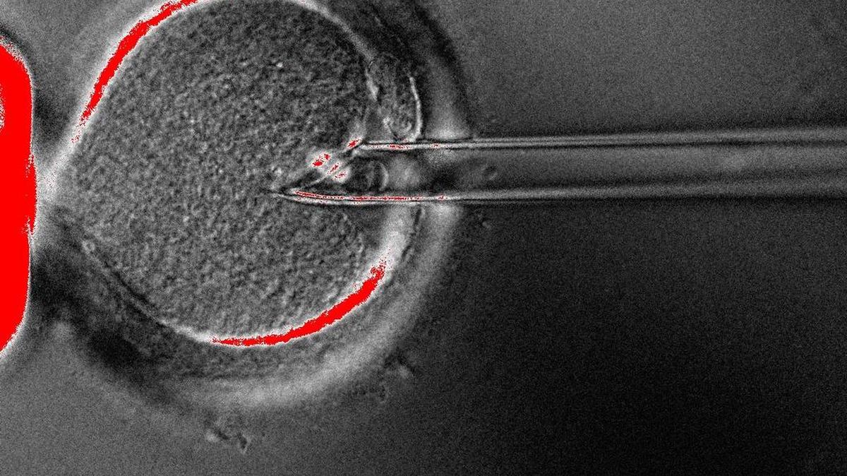 Científicos del Centro OHSU de Células Embriónicas y Terapia Genética sacan el núcleo de un óvulo humano.