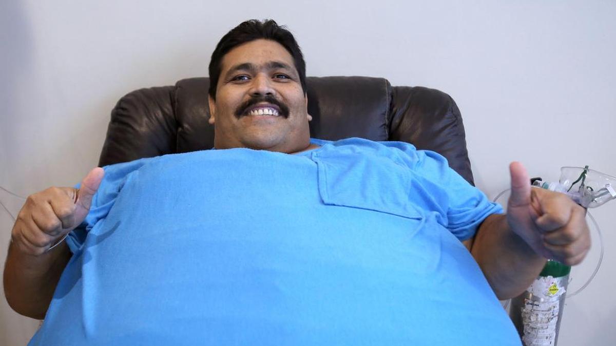 El mexicano Andrés Moreno, considerado el hombre más obeso del mundo, participa en una rueda de prensa el miércoles 25 de noviembre de 2015, en la ciudad de Guadalajara, México. Moreno falleció el viernes de un infarto.
