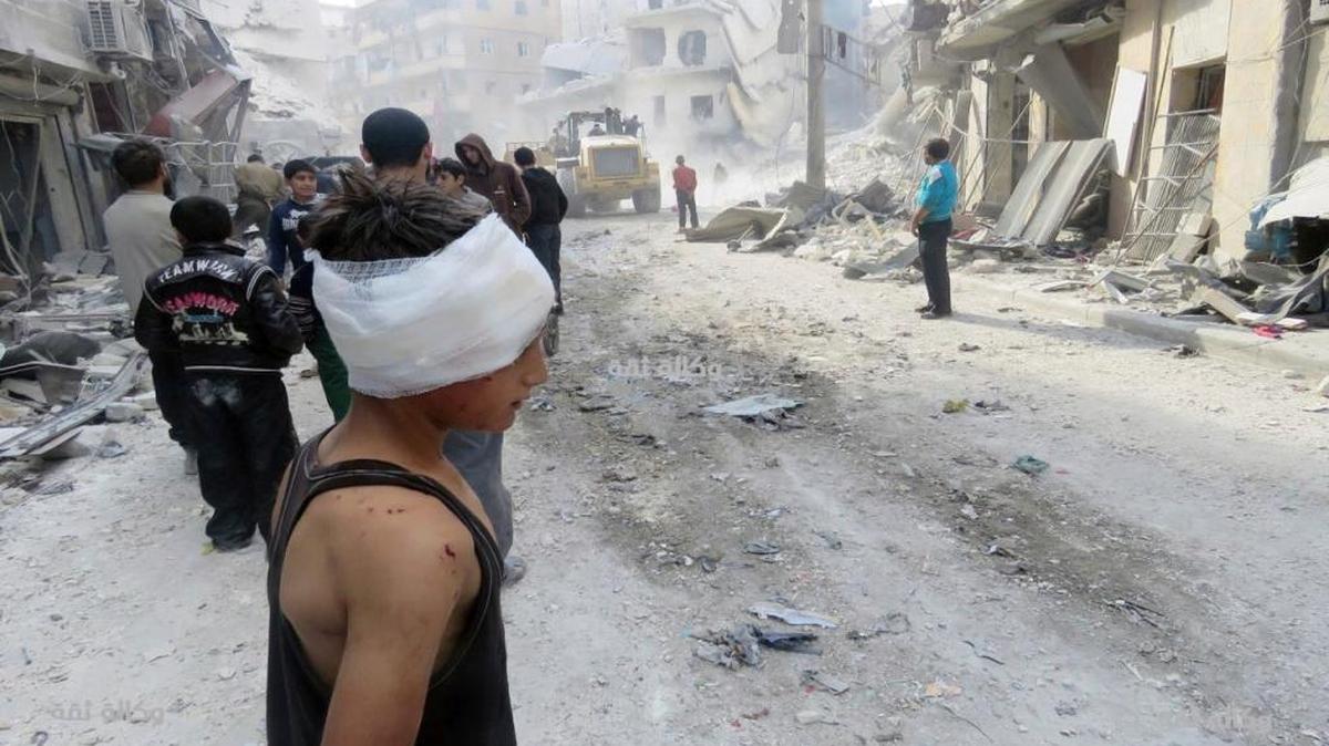 Un niño herido en un bombardeo en Aleppo, Syria, en noviembre.