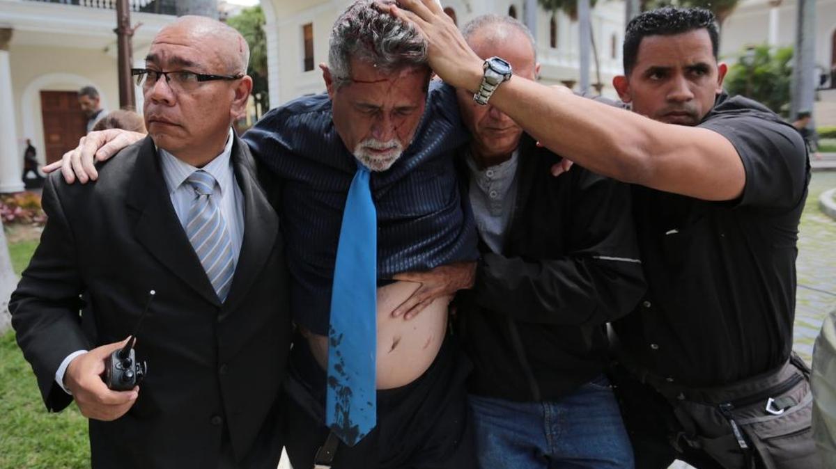 El legislador de la oposición Américo De Grazia recibe ayuda de guardaespaldas y un empleado de la Asamblea Nacional después de ser herido en el ataque al organismo legislador por partidarios del gobierno, el 5 de julio, en Caracas.