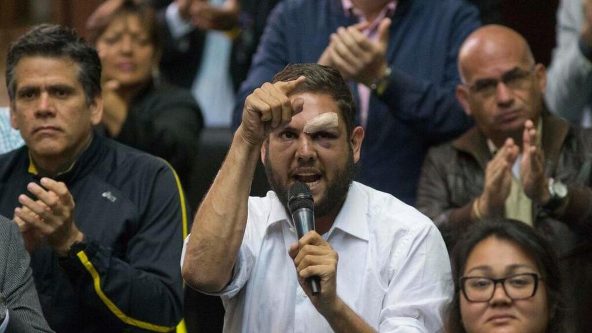 El diputado opositor venezolano Juan Requesens, a quien el régimen de Nicolás Maduro le inventó un complot contra el gobierno para poder encarcelarlo.