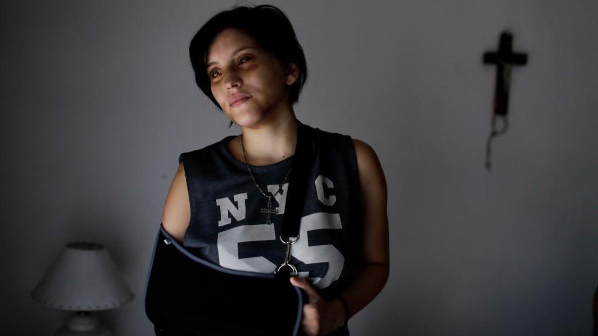 Belén Torres posa en Buenos Aires, Argentina, en febrero. Ella fue golpeada por su jefe que la quiso forzar a tener relaciones sexuales.