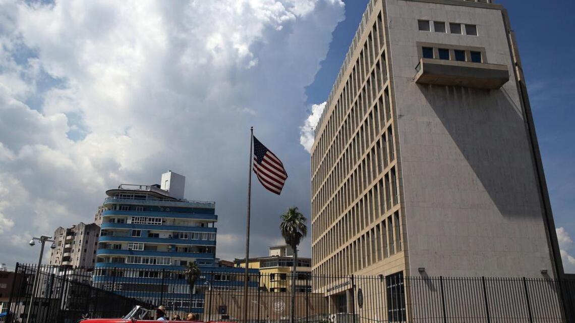 Diplomáticos estadounidenses en Cuba sufren daños cerebrales (sindicatos)