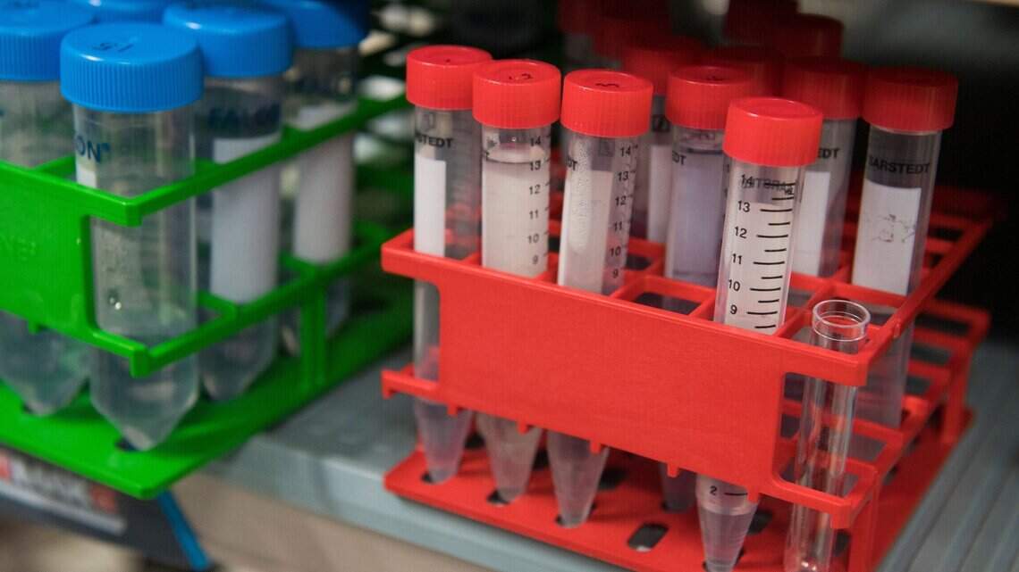 Prueba de sangre detectaría el cáncer 4 años antes que métodos convencionales, según estudio