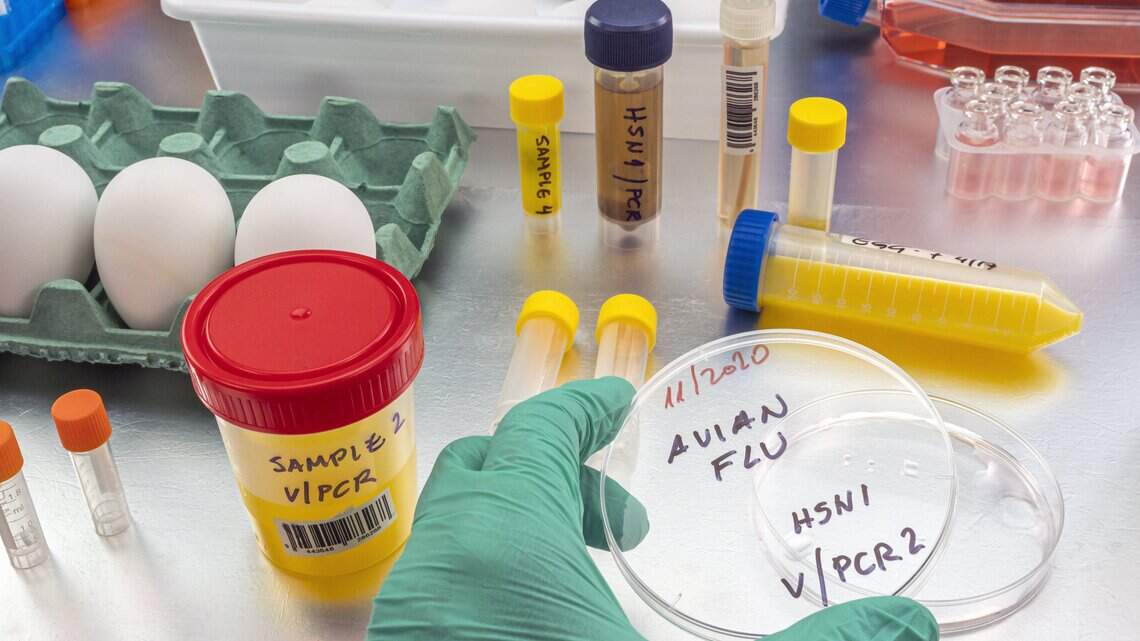 Los virus de la gripe aviar resisten la fiebre, el arma humana para combatir la enfermedad