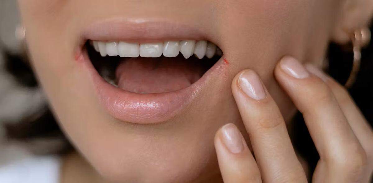 Hay muchos tipos de&nbsp;herpes distintos: herpes simple tipo 1 y 2, varicela-zóster, Epstein-Barr, citomegalovirus… Son los virus más comunes y persistentes del ser humano. 