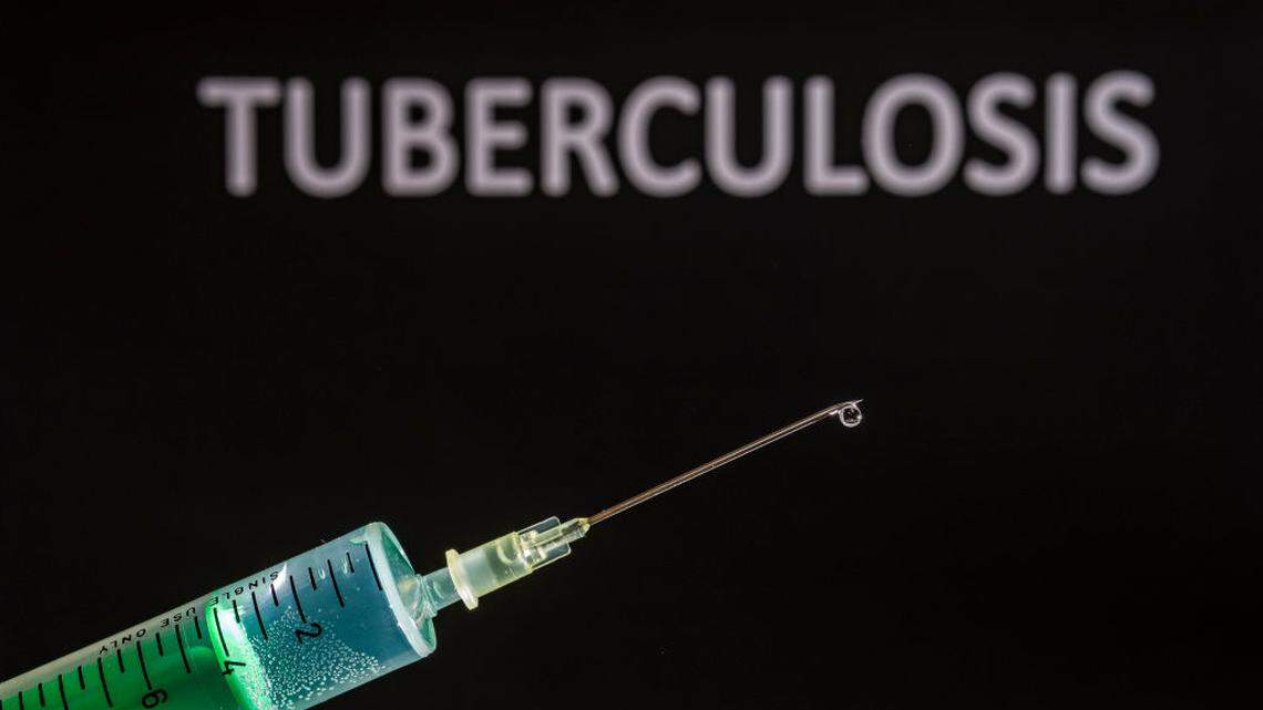 Farmacéutica española incorpora a renombrado científico cubano para ultimar vacuna de la tuberculosis
