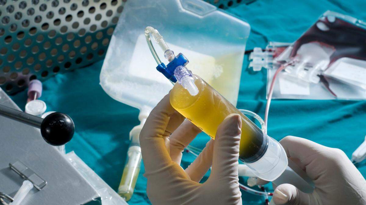 Los exosomas llegaron, literalmente, en el momento preciso y salvaron el juego; aquellos pacientes de más de 50 años pueden utilizar los exosomas de placenta y cordón umbilical, solos o combinados con sus propias células.