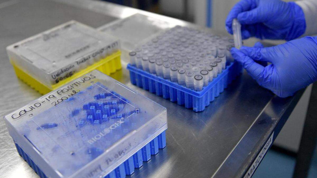 A researcher works on blood samples of COVID-19 patients, as part of a project which seeks to test the effectiveness of the use of plasma of patients who recovered from the new coronavirus in the treatment of patients where the virus is active, at the District Institute of Science, Biotechnology and Innovation in health (IDCBIS) in Bogota on August 12, 2020. (Photo by Raul ARBOLEDA / AFP) (Photo by RAUL ARBOLEDA/AFP via Getty Images)