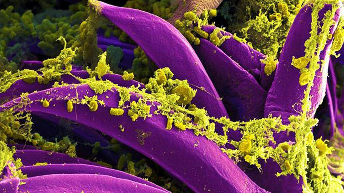 South Lake Tahoe resident tests positive for plague, CA officials say. What to know