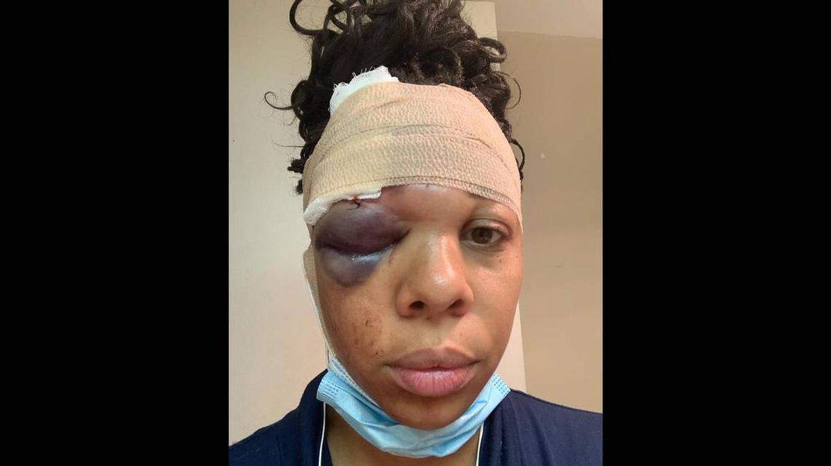LaToya Ratlieff tras haber sido baleada por la policía en mayo del 2020.