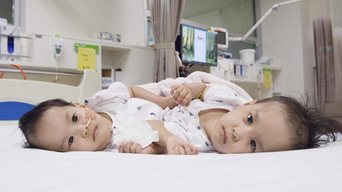 Nima y Dawa Pelden llegaron a Australia en octubre junto a su madre para ser operadas.