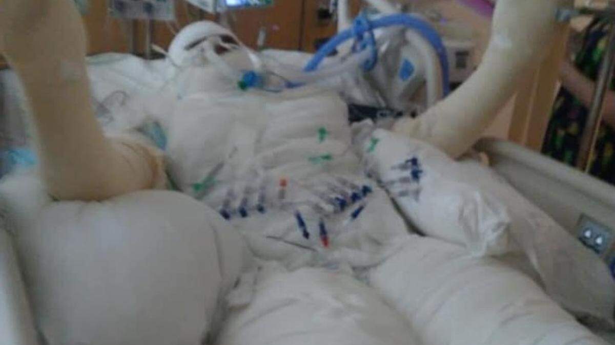 Una menor de 12 años de Michigan, EEUU, sufrió quemaduras en su rostro y gran parte de su cuerpo después de unirse al ‘Reto del Fuego’.