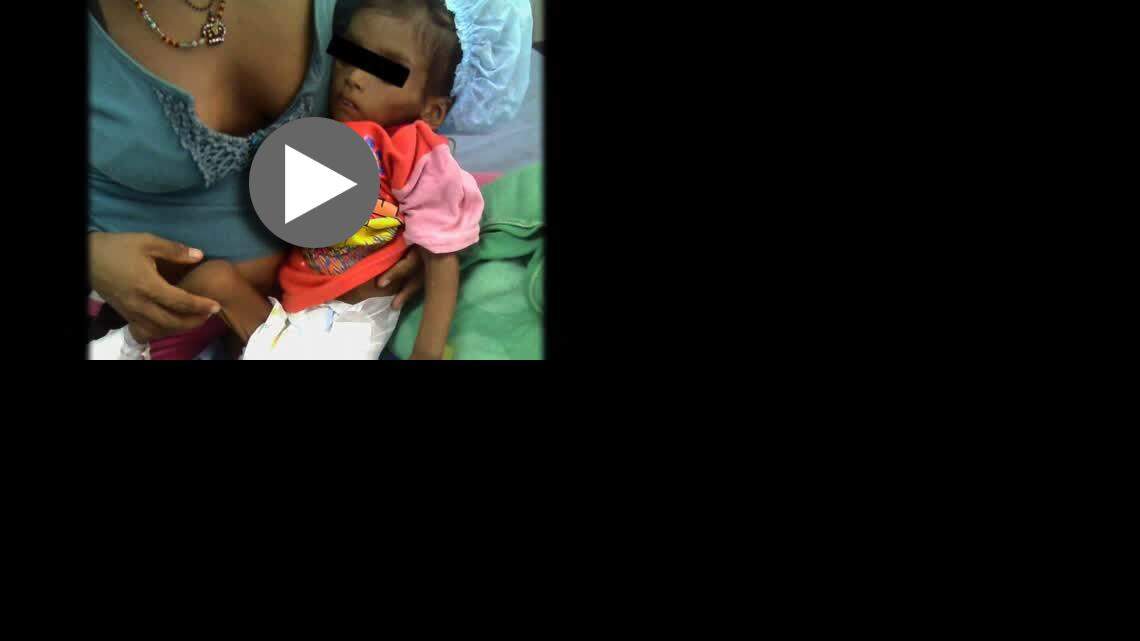 El diputado opositor William Barrientos dio a conocer este video en el que denuncia las condiciones de desnutrición de niños venezolanos debido a la severa crisis económica que golpea al país, considerado alguna vez como una de las más prósperas naciones sudamericanas.