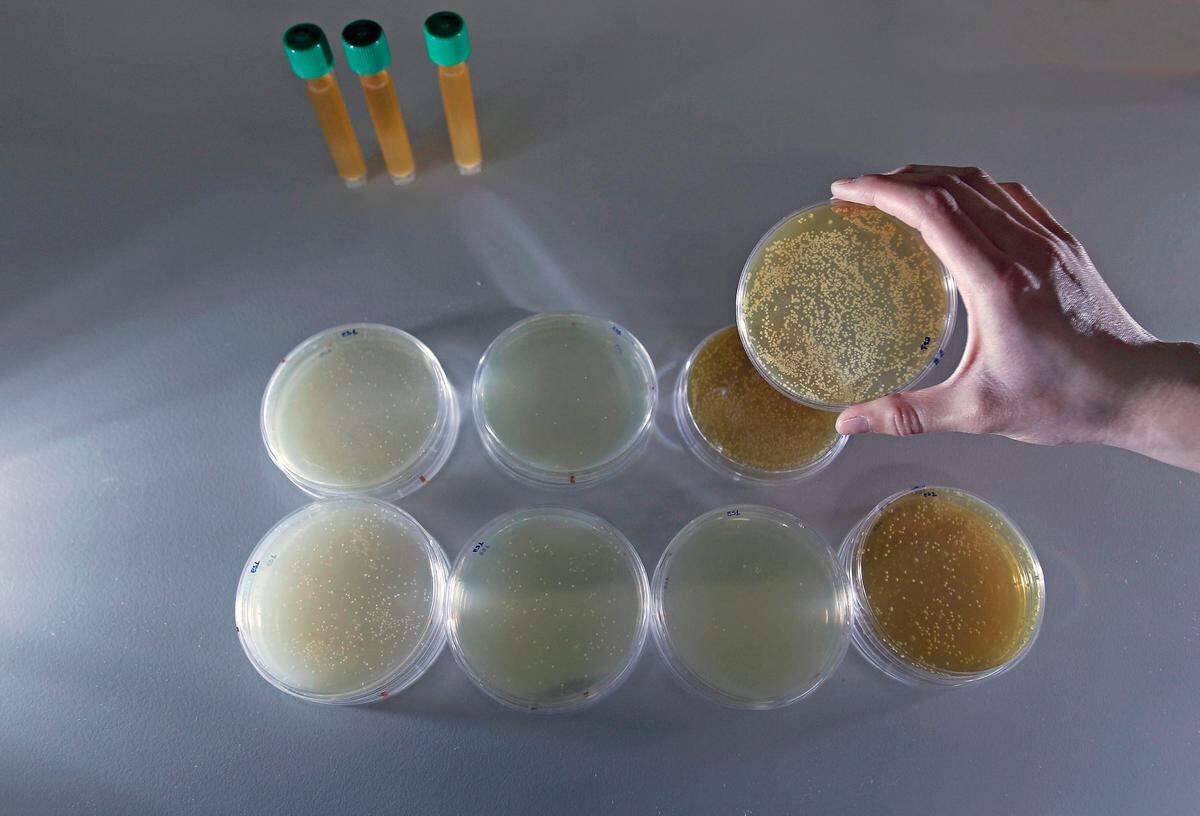 Una técnico del laboratorio de microbiología de Biopolis sujeta una placa con una muestra de probióticos. Los probióticos están presentes en una creciente gama de productos de la ‘alimentación funcional’.