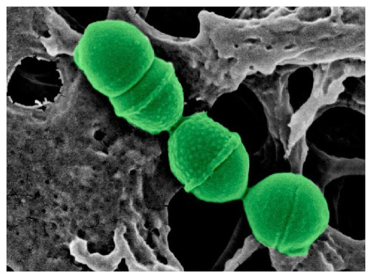 Streptococcus dentisani de microscopía electrónica coloreada. / Anny Camelo Castillo. FISABIO, Author provided
