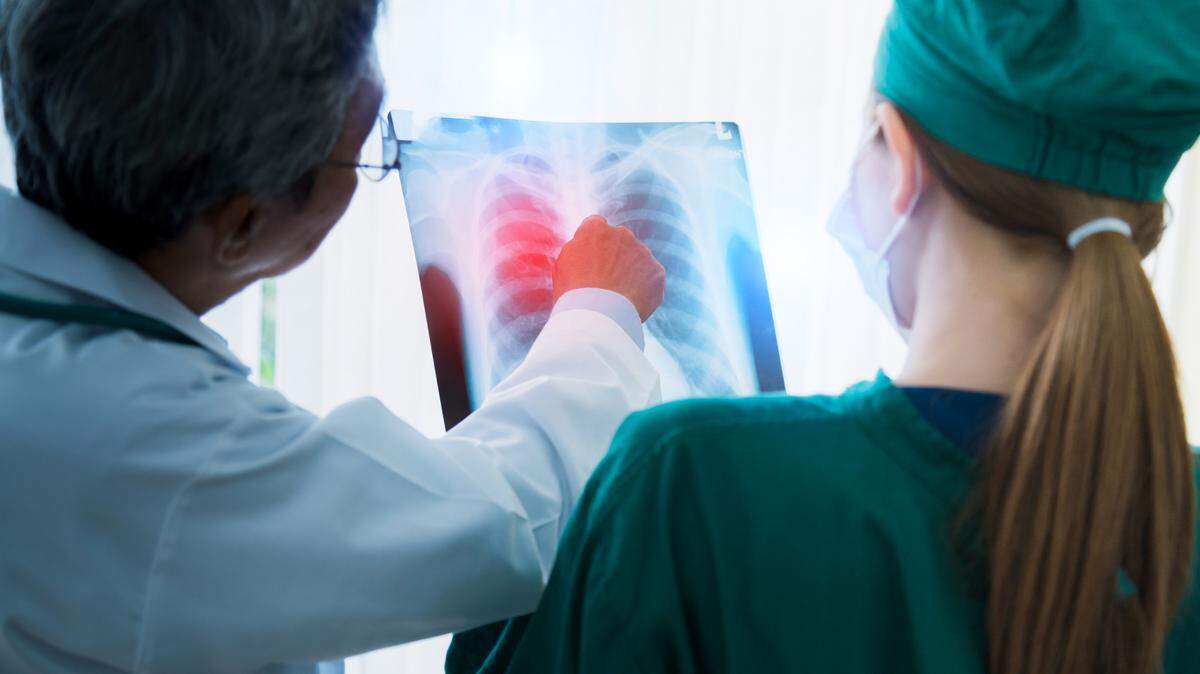 La Organización Mundial de la Salud (OMS) destaca que el cáncer de pulmón es la causa principal de muertes relacionadas con el cáncer en todo el mundo y su tasa de mortalidad es la más elevada tanto entre hombres como entre mujeres.