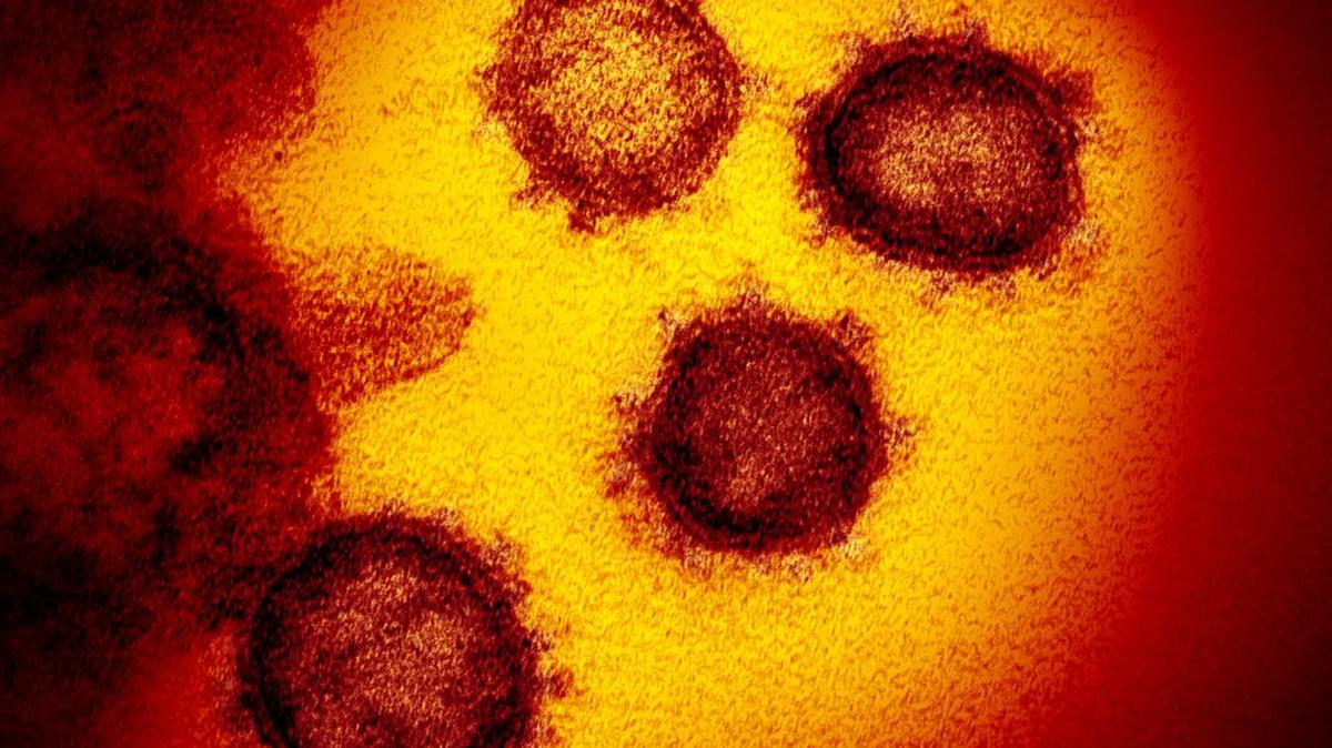 This transmission electron microscope image shows SARS-CoV-2, also known as 2019-nCoV, the coronavirus that causes COVID-19.