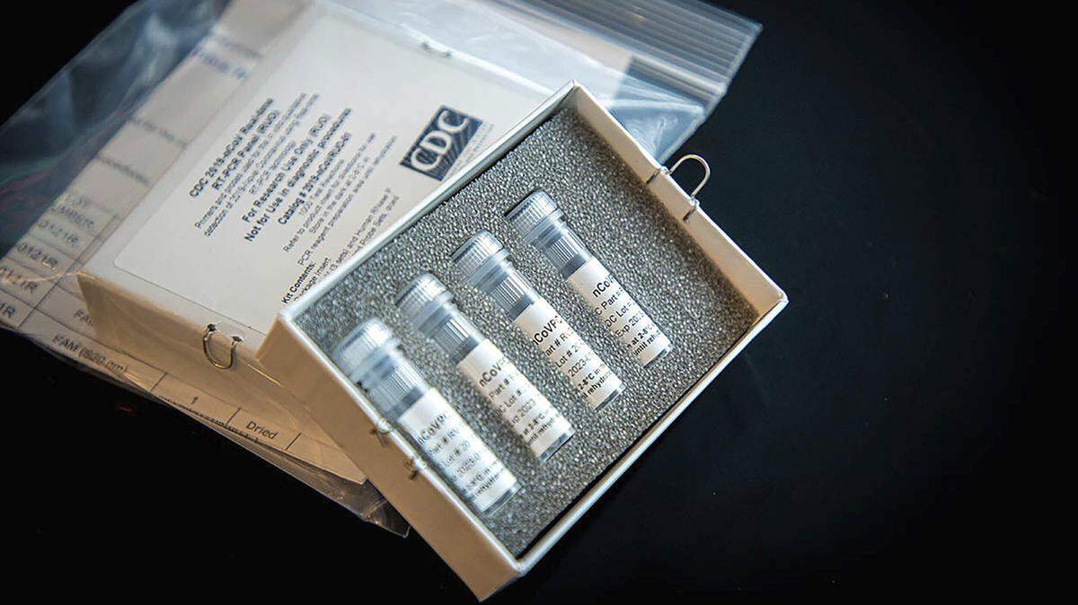 Foto sin fechar proporcionada por los Centros para el Control y la Prevención de Enfermedades (CDC) de EEUU, que muestra el kit de prueba de laboratorio para el nuevo coronavirus.