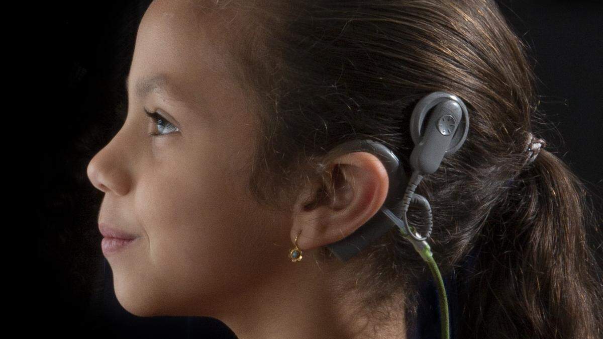 Marcia Guillou, de 6 años, lleva un implante coclear bilateral que le permite oír.