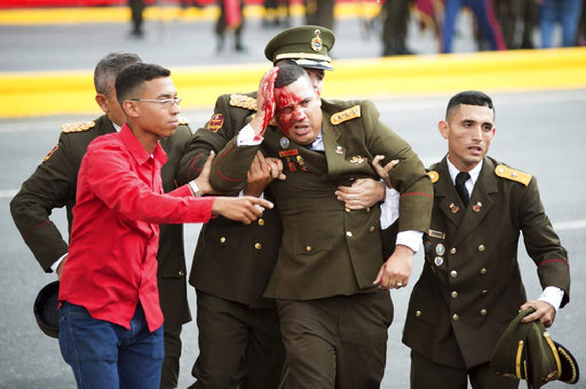 Un militar venezolano sangra de una herida en la cabeza tras un incidente ocurrido durante un discurso del presidente Nicolás Maduro en Caracas el 4 de agosto del 2018,