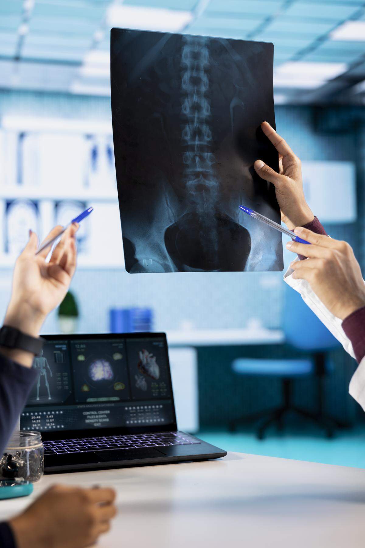 Las espondiloartritis afectan fundamentalmente a la espalda y a las articulaciones. Suelen aparecer en personas jóvenes, entre la adolescencia y los 50 años. 