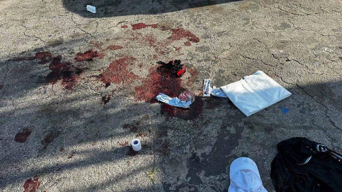Three men were hospitalized after a stabbing in a Westchester neighborhood early Thursday, according to Miami-Dade deputies.