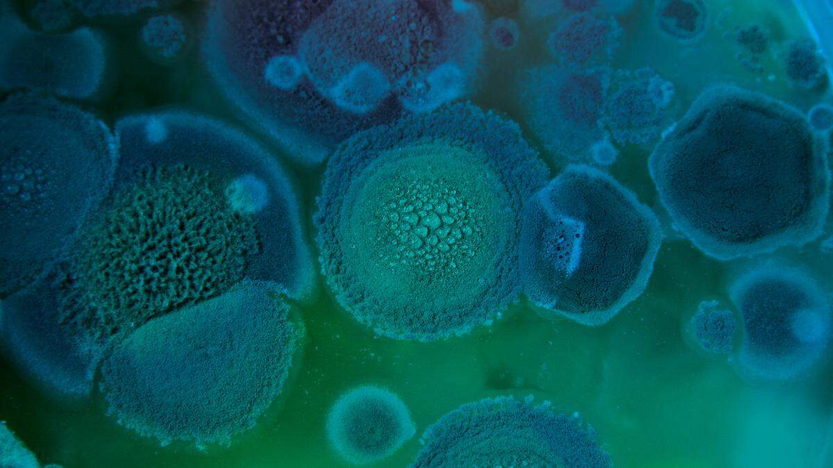 Aspergillus fumigatus - Fotografía abstracta de moho en una bandeja. ARCHIVO