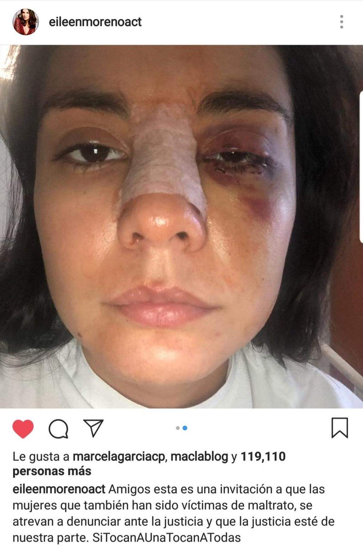 La actriz Eileen Moreno denunció que fue víctima de abusos físicos por parte de su novio.