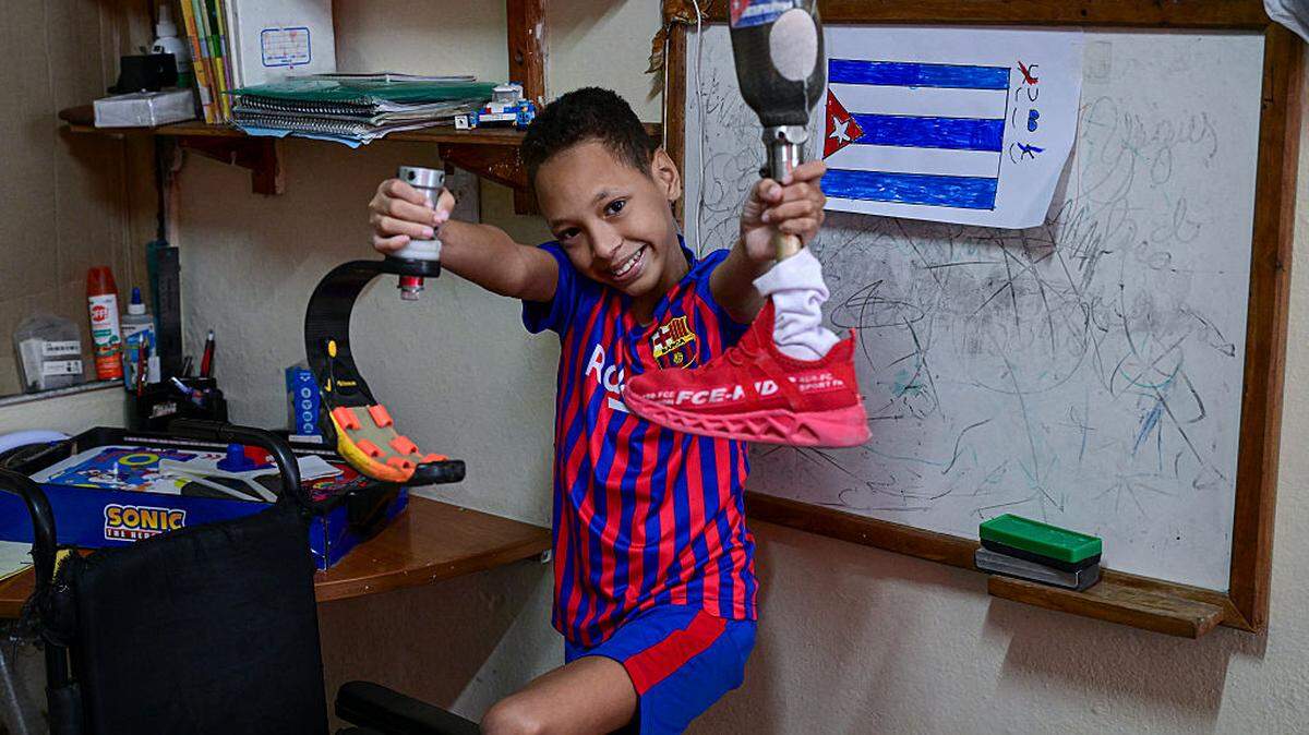 Juan José Guilarte posa para una fotografía con sus prótesis en su hogar en La Habana, el 22 de abril de 2026. Juan José, quien sueña con convertirse en deportista, nació en Cuba con una malformación congénita: su pierna izquierda se desarrolló únicamente hasta el fémur y la rótula. Esta condición, según su familia, nunca lo frenó; aunque ahora, una cirugía sin fecha programada ha limitado su entrenamiento.