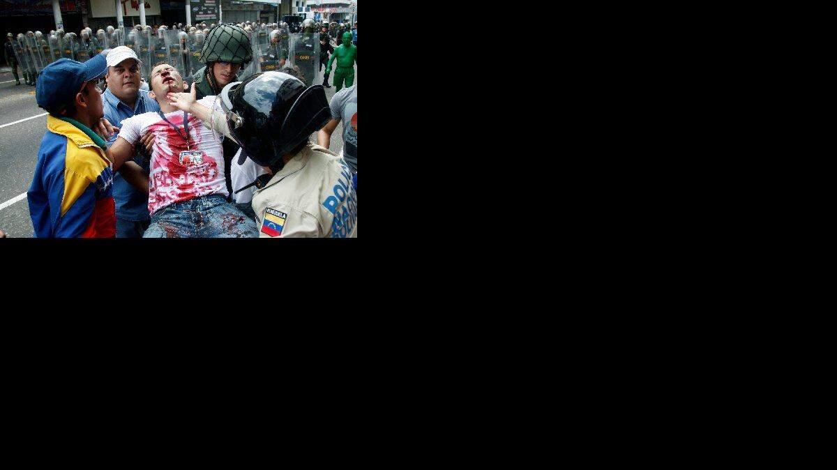 Un estudiante herido durante una protesta contra el gobierno de Nicolás Maduro es ayudado por varias personas, el 12 de febrero de 2015, en San Cristóbal, Venezuela. En un informe el jueves la Comisión Interamericana de Derechos Humanos (CIDH) incluyó a Venezuela y Cuba como los países con el mayor registro de violaciones de derechos humanos en el continente. 