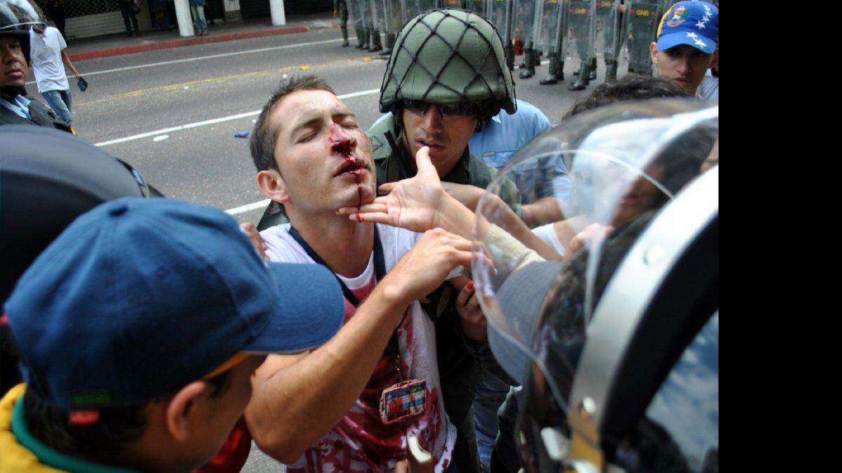 Los miembros de la guardia nacional llevan un estudiante herido durante una protesta contra el gobierno del presidente de Venezuela, Nicolás Maduro, en San Cristóbal, Venezuela el 12 de febrero de 2015.